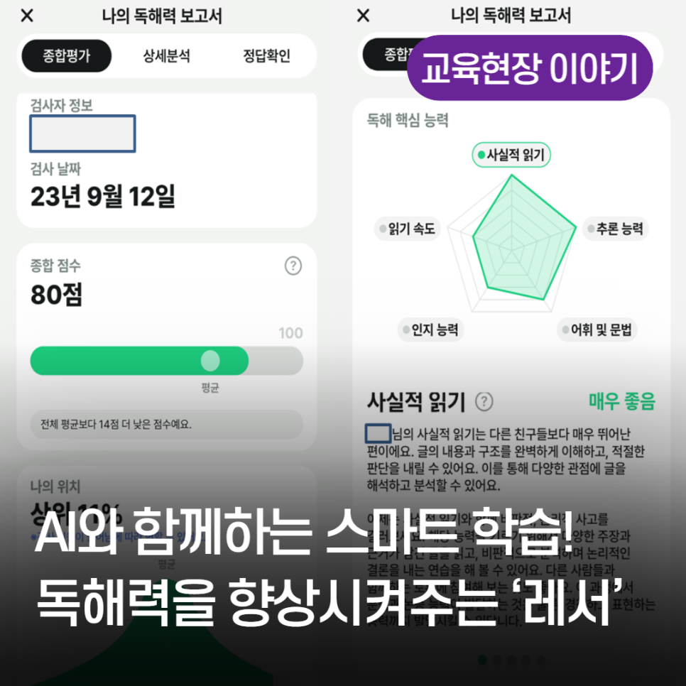 레서 이미지