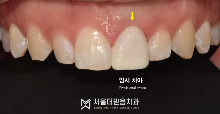 서울더믿음치과 이미지