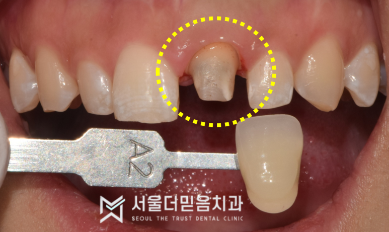 서울더믿음치과 이미지
