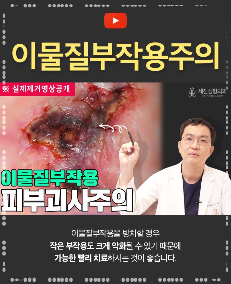 세진미래투자 이미지