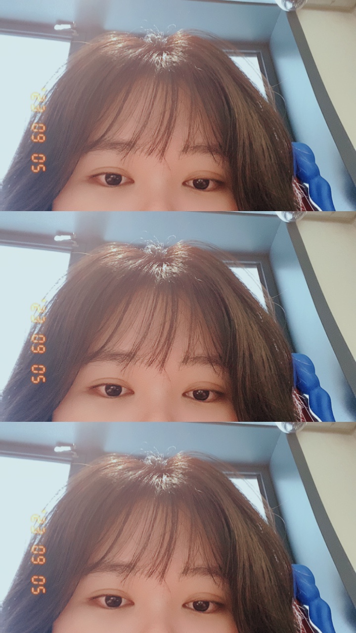 강아지 중성화 수술 후 회복 및 30살 생일 코로나 경험 — 사진 7