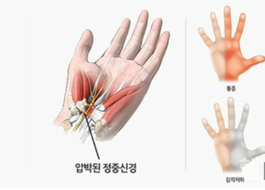 수앤테라피 이미지