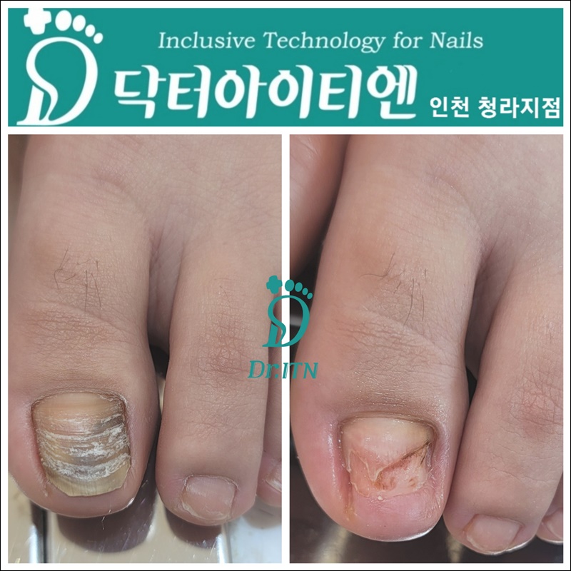 네일위드유 이미지
