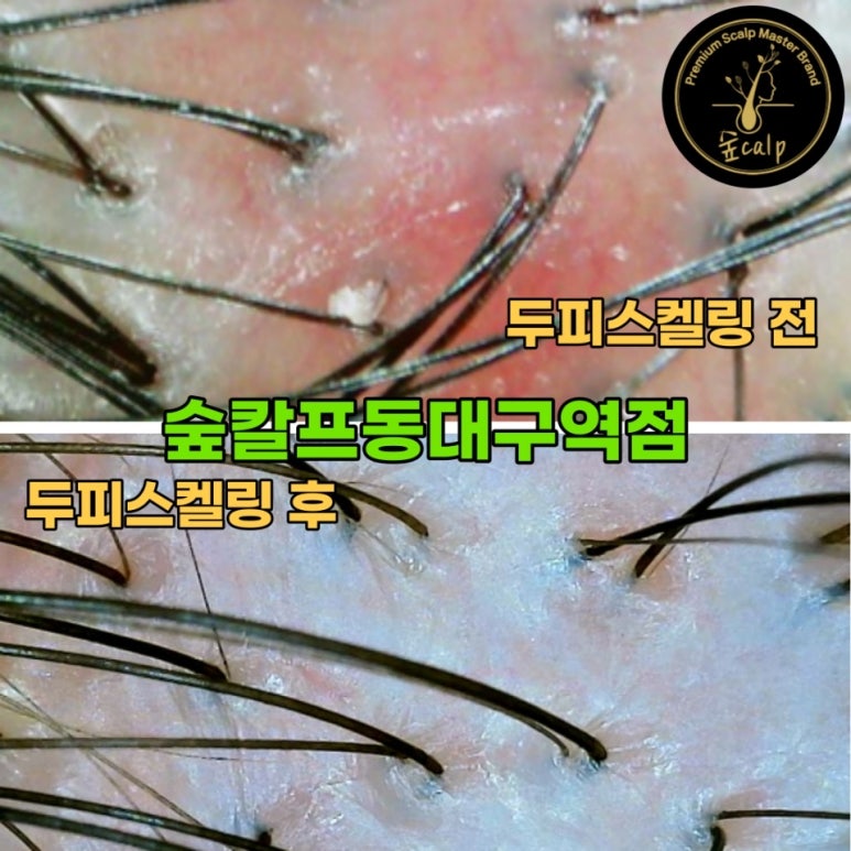 숲칼프 동대구역점 이미지