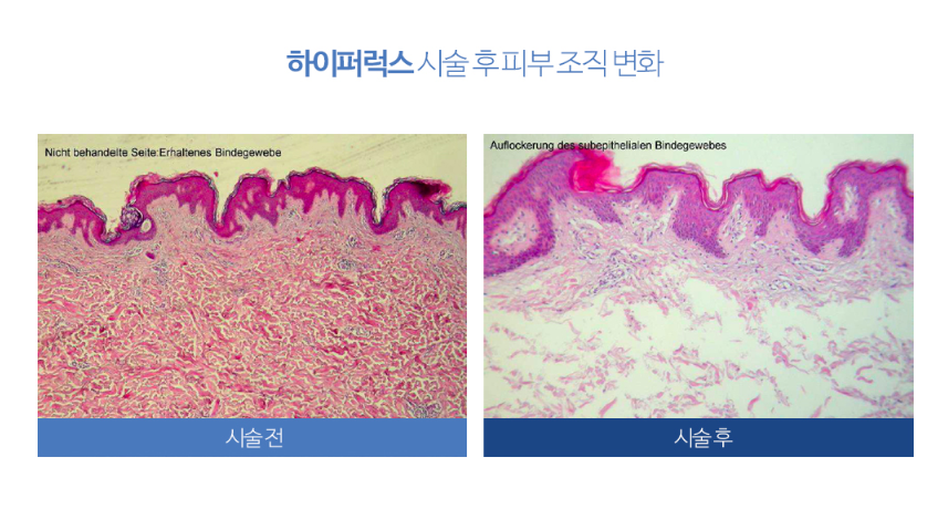 아우라럭스 이미지
