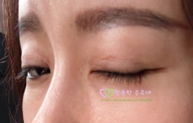 넬라스 이미지