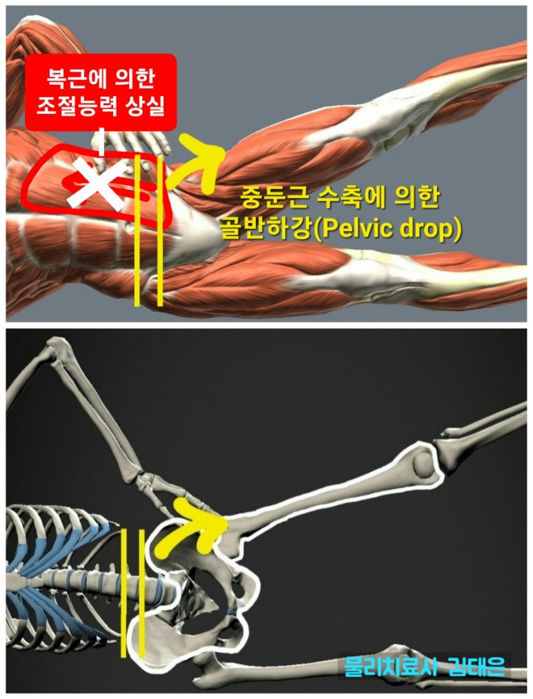 사이드킥 이미지