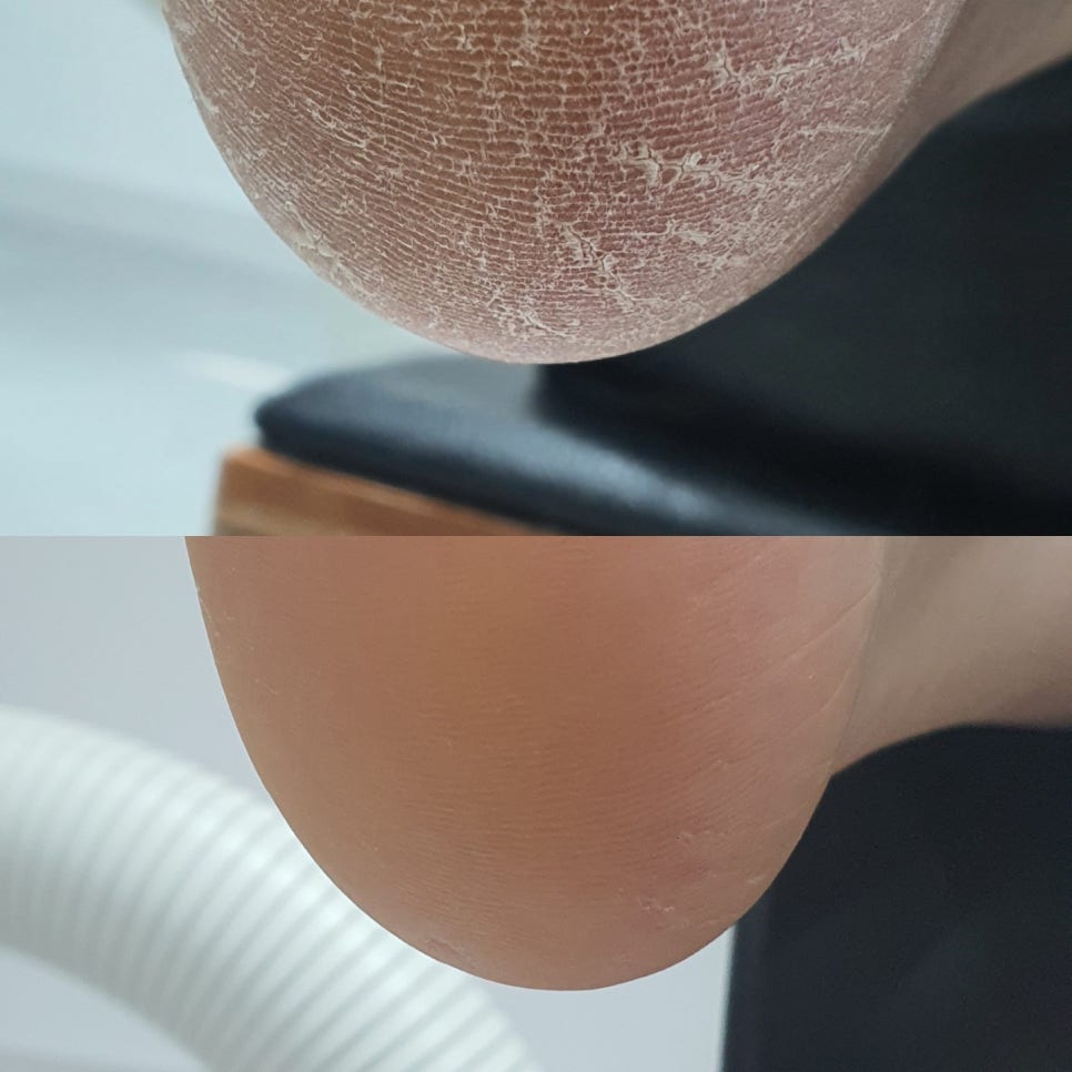 멋진발관리 이미지