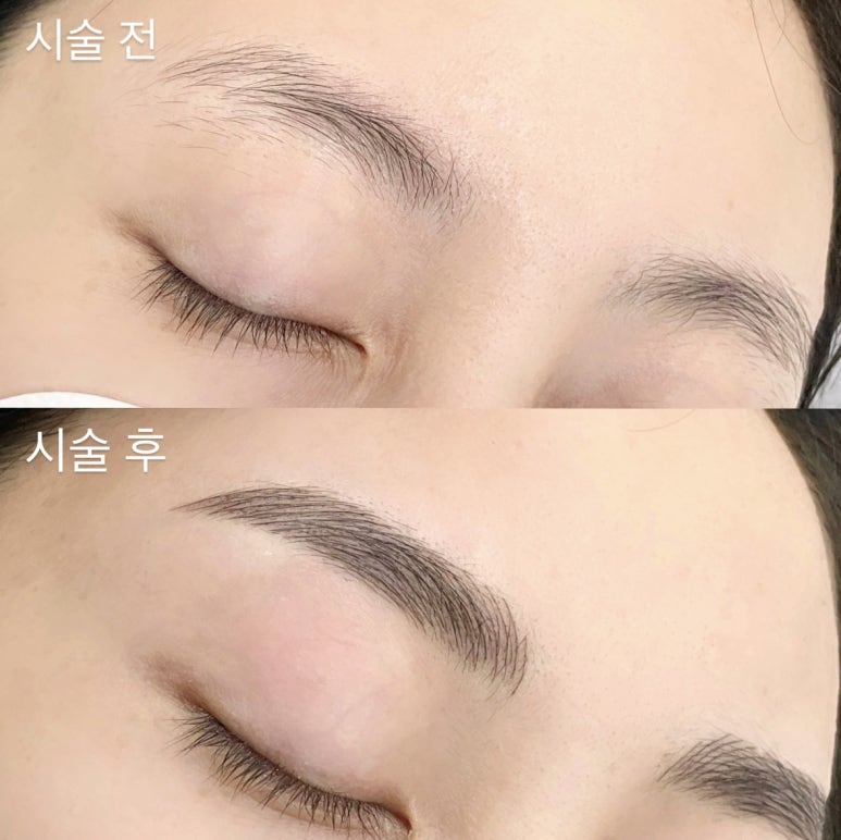 리메이드 이미지