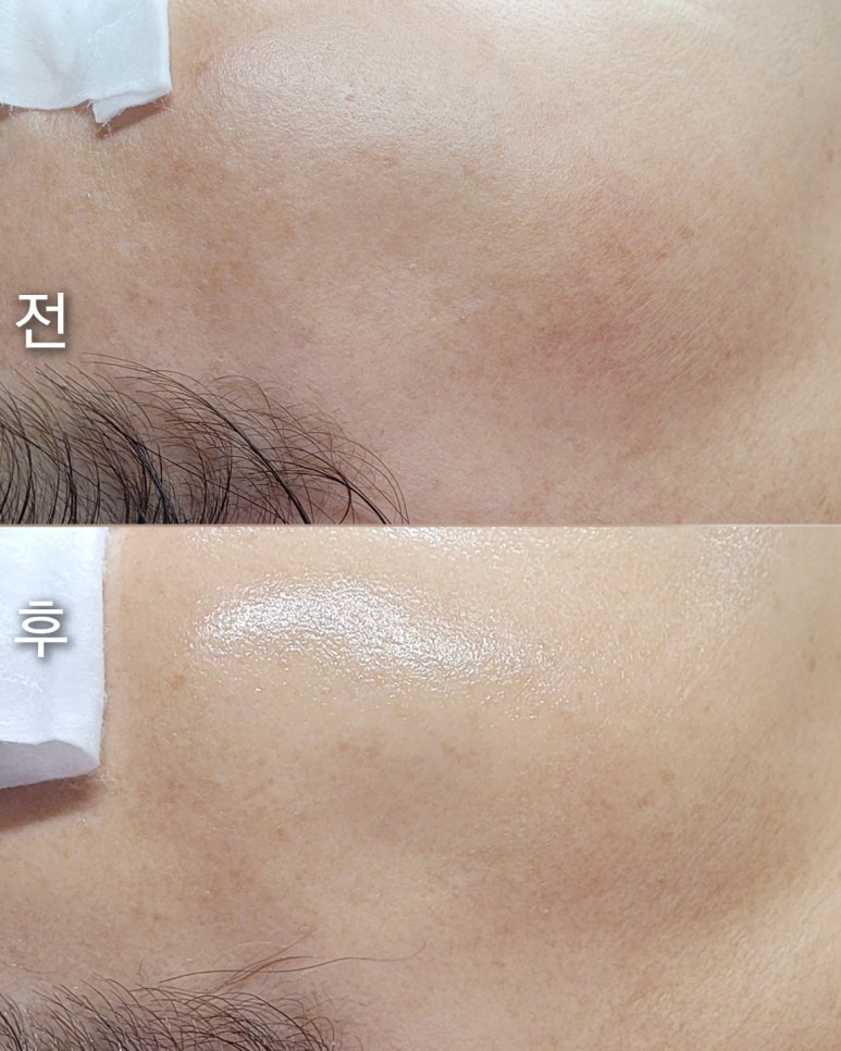 휴테라피 이미지