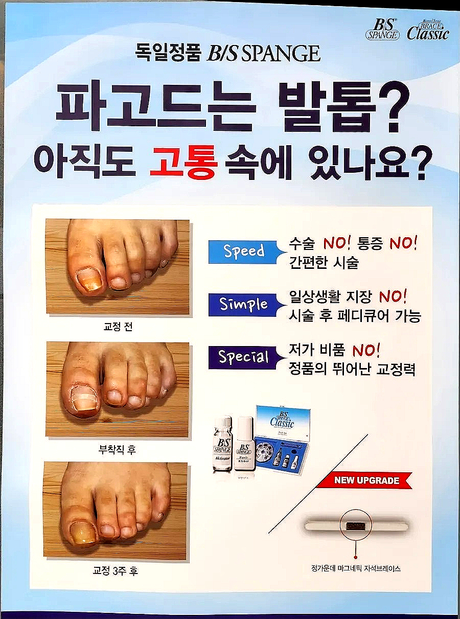 멋진발관리 이미지
