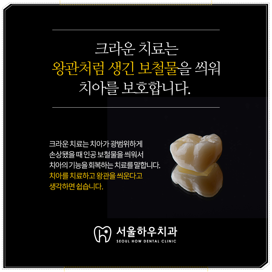 서울하우치과 이미지