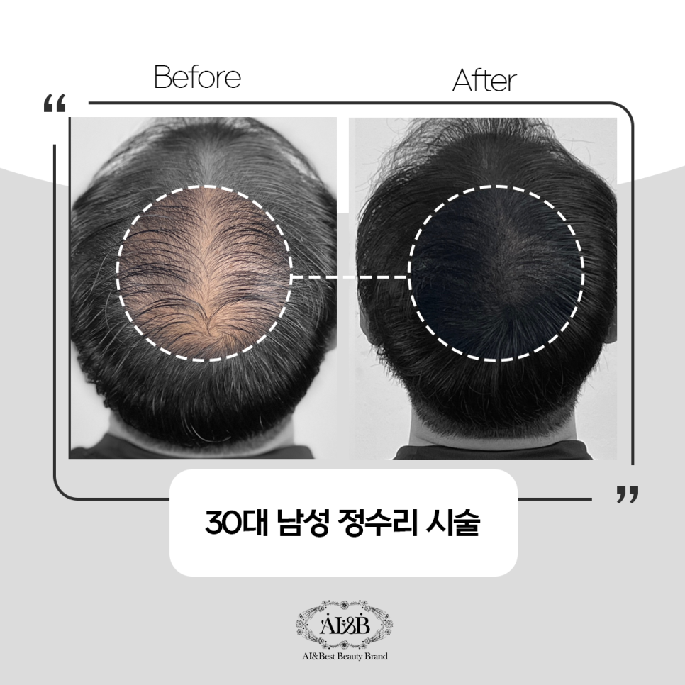 에이아이앤비 이미지
