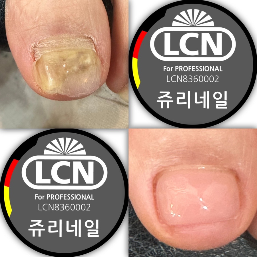 쥬리네일 이미지