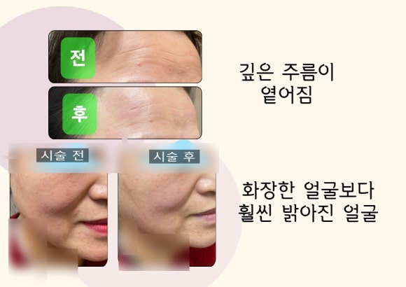 숲칼프 동대구역점 이미지