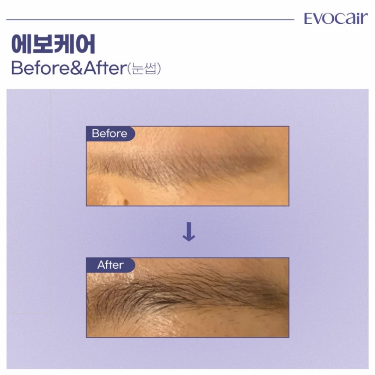 리가뷰티오피셜 이미지