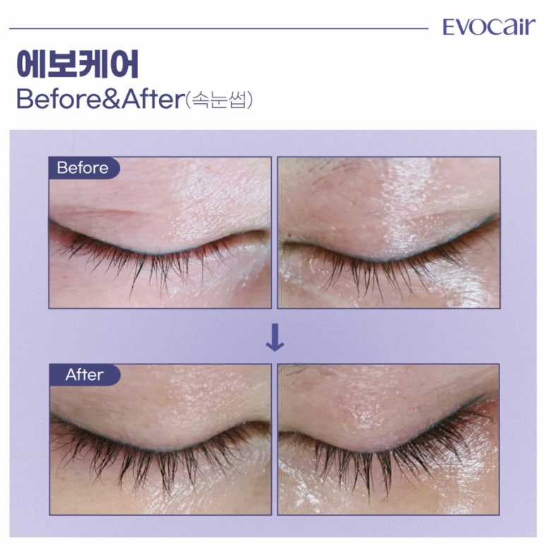 리가뷰티오피셜 이미지