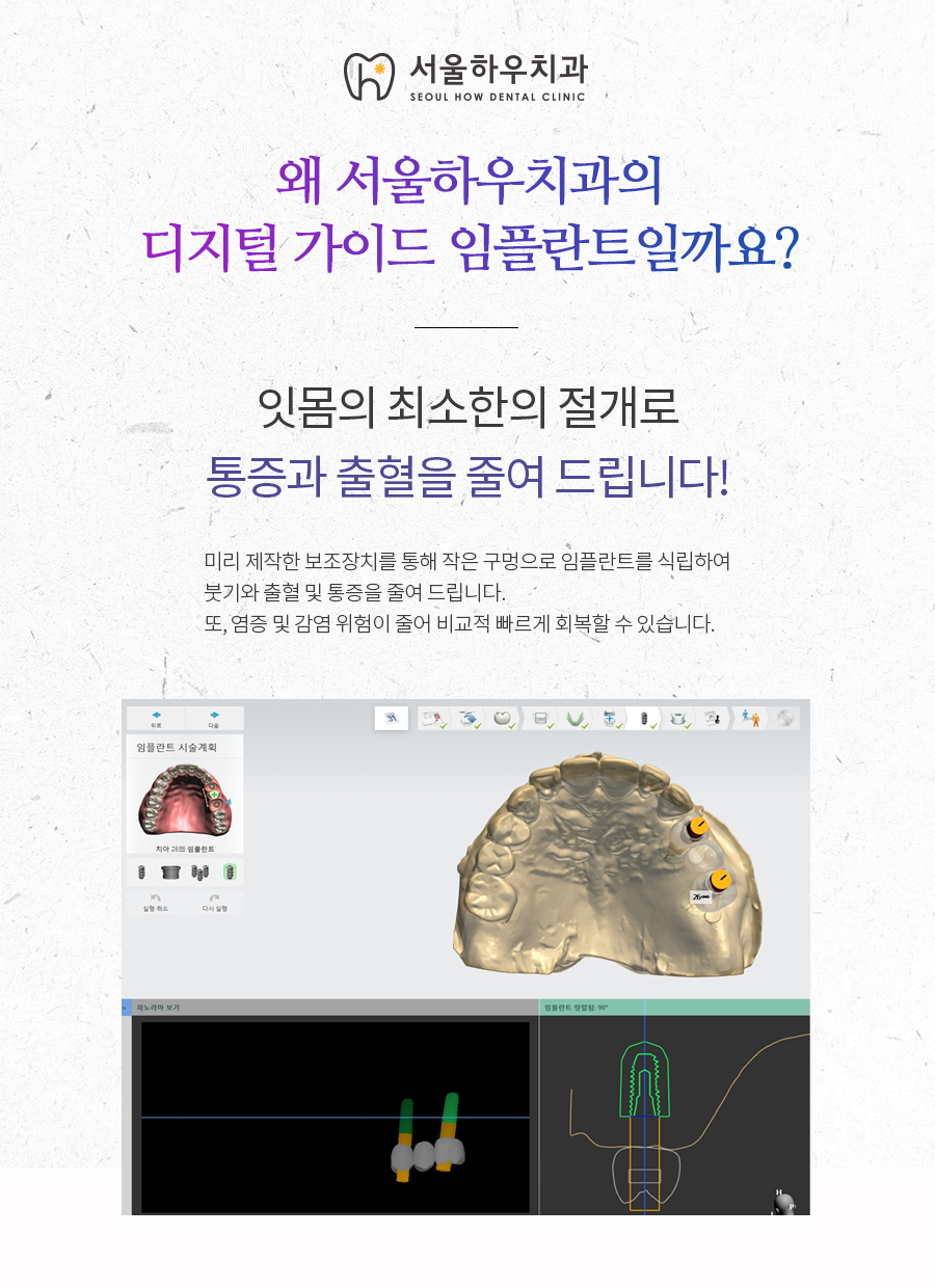 서울하우치과 이미지