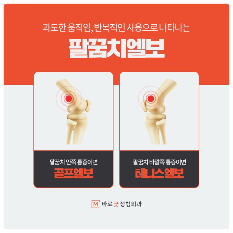 바로정형외과 이미지