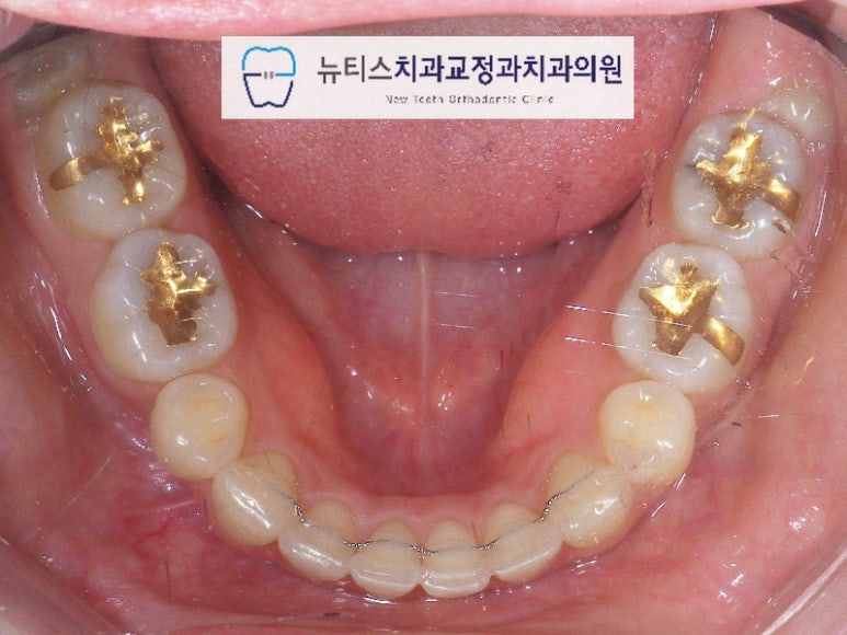 뉴티스치과교정과치과의원 이미지