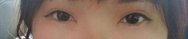 플로르성형외과 이미지