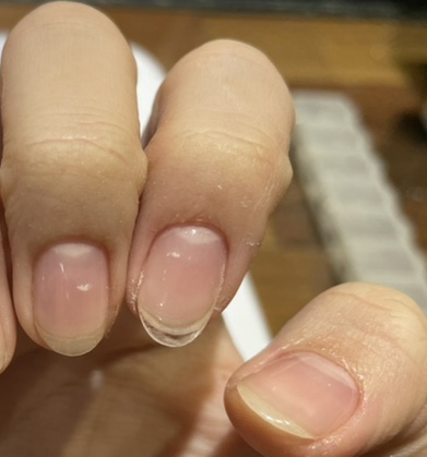 일미리(1mm) 이미지