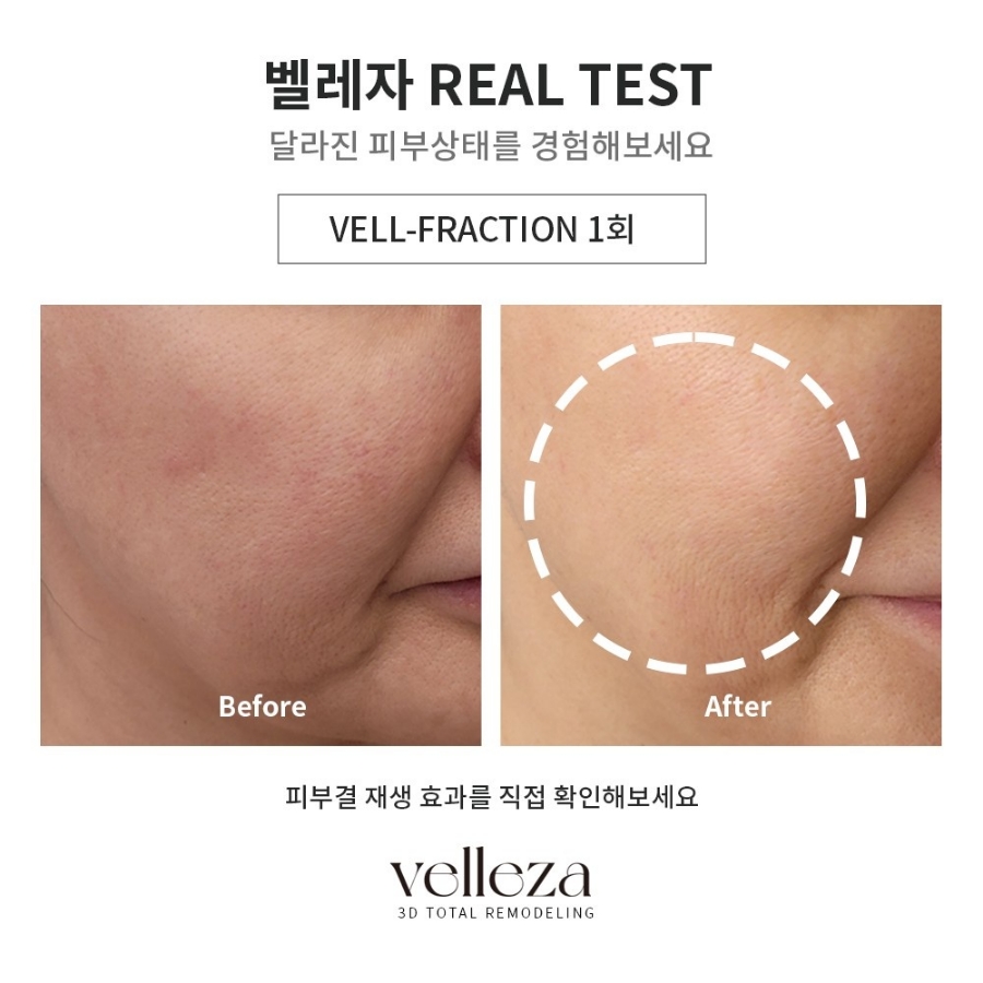 애플스킨 이미지