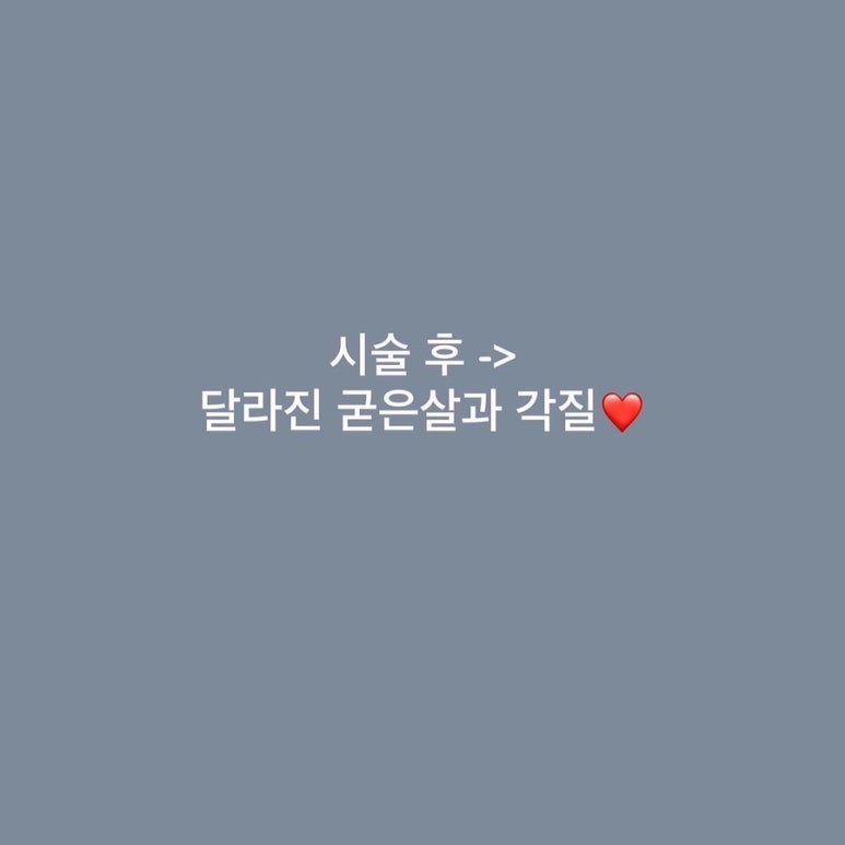 온니네일 이미지