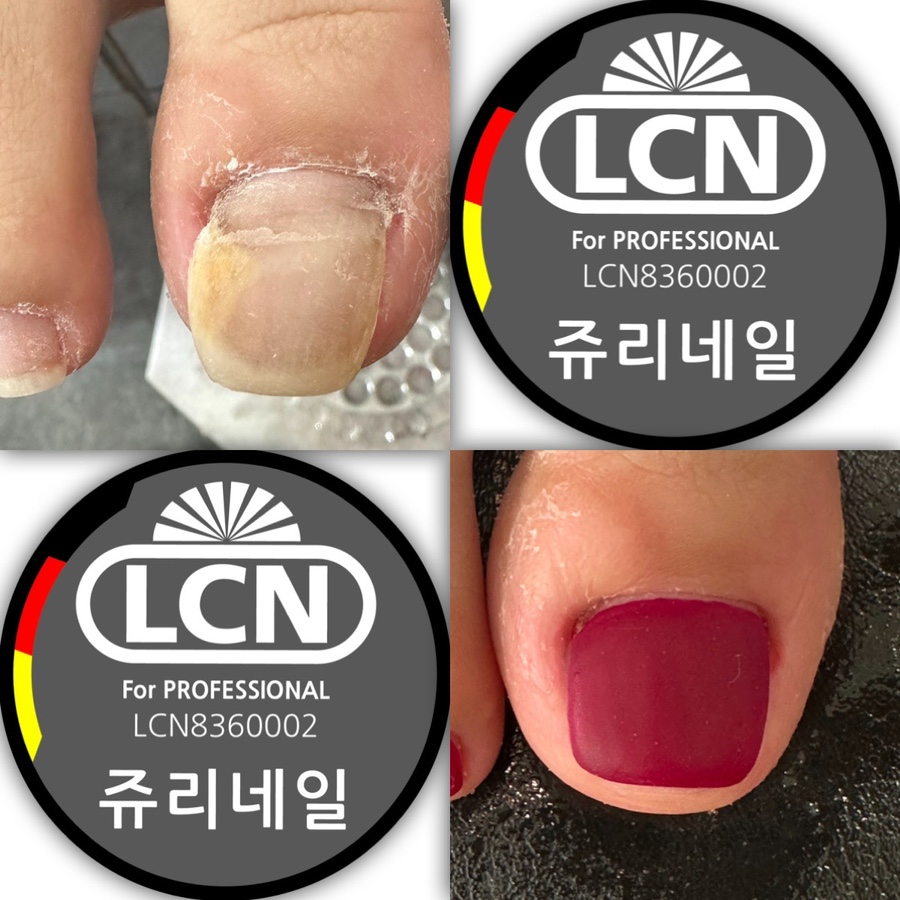 쥬리네일 이미지