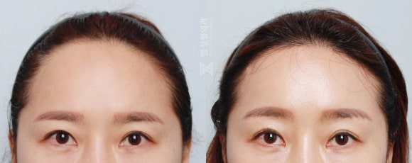 젤성형외과의원 이미지
