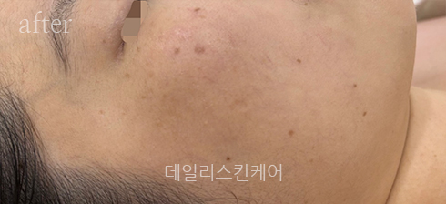 영주스킨케어 이미지
