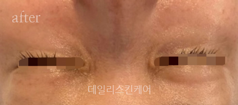 영주스킨케어 이미지