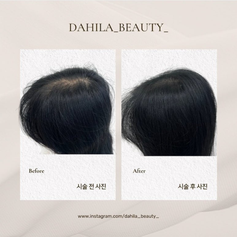 소소뷰티 이미지