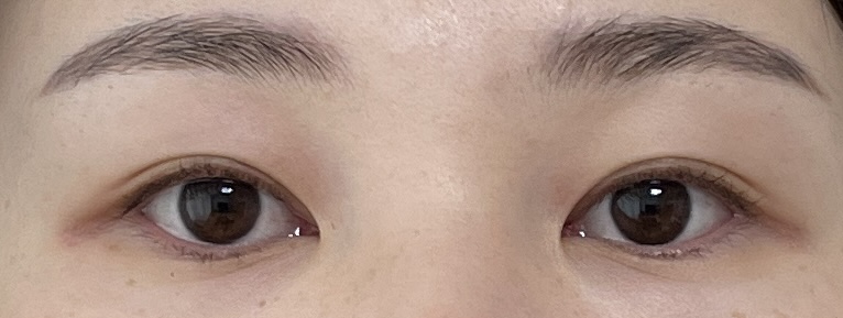 엘스네일 이미지