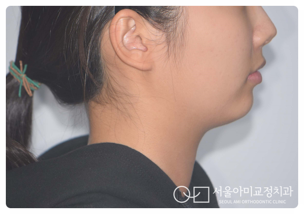 아미치과 이미지