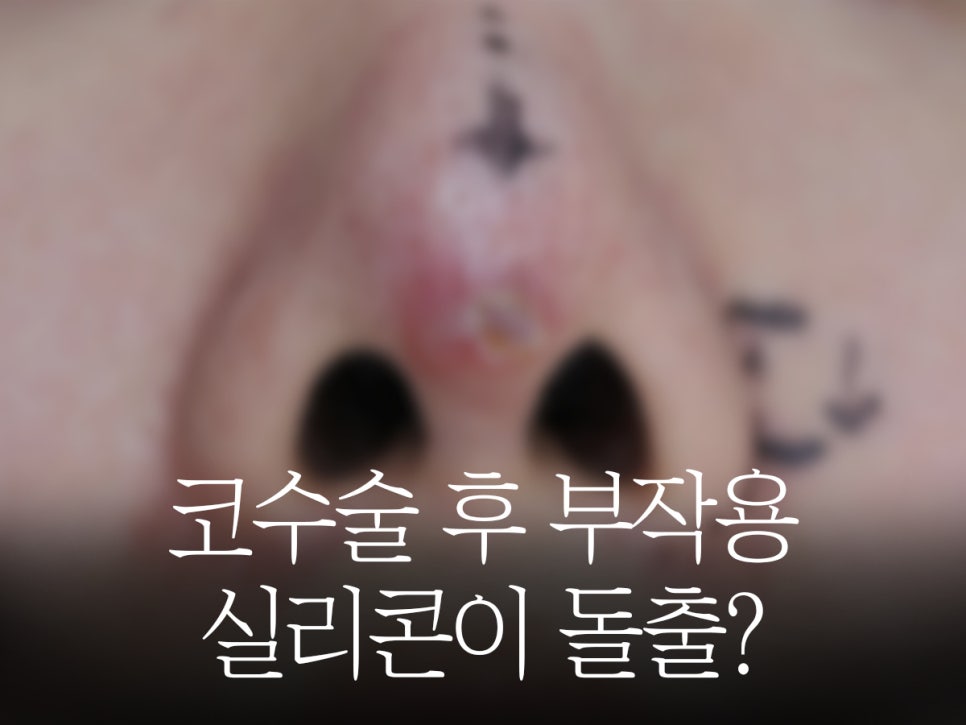아너스티성형외과의원 이미지