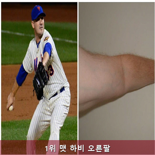 캐리앤지 이미지