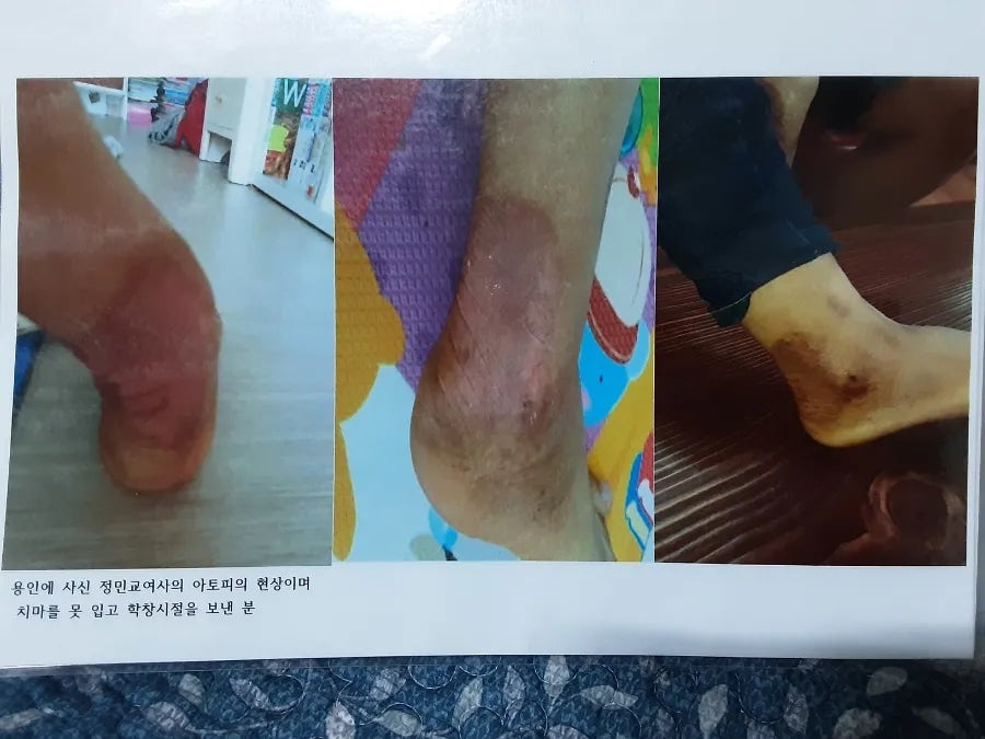 장수 엽록소 이미지