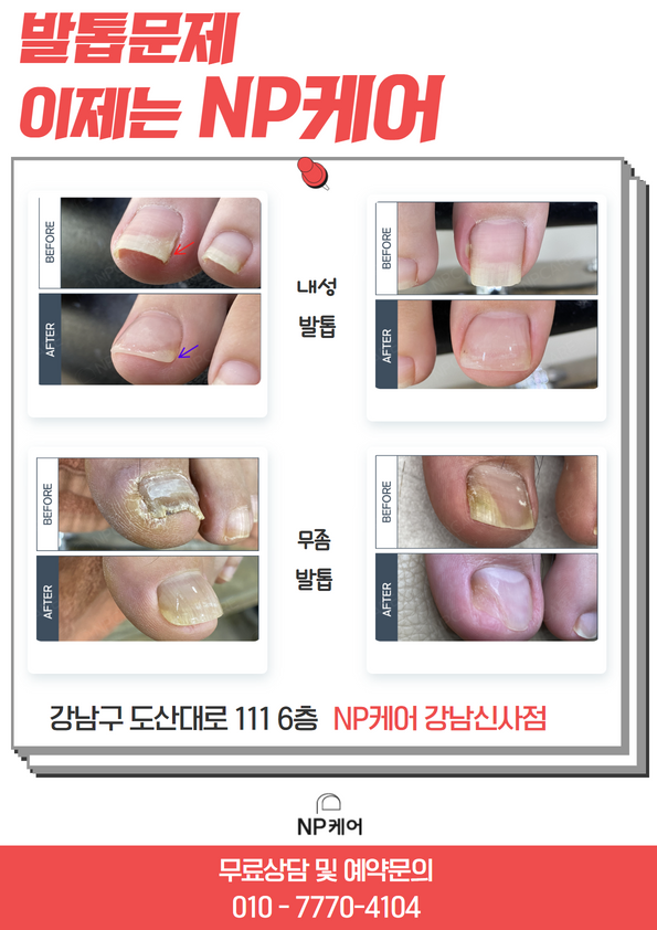엔피케어강남 이미지