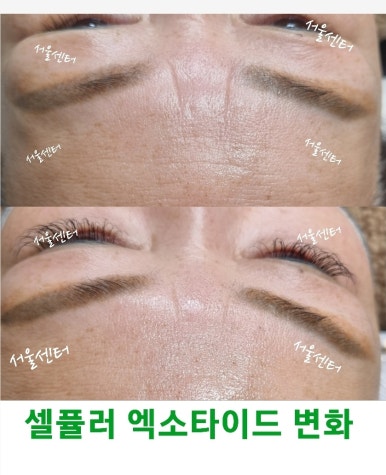 눈타이드 이미지