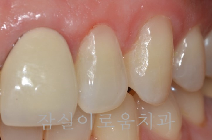 잠실이로움치과 이미지