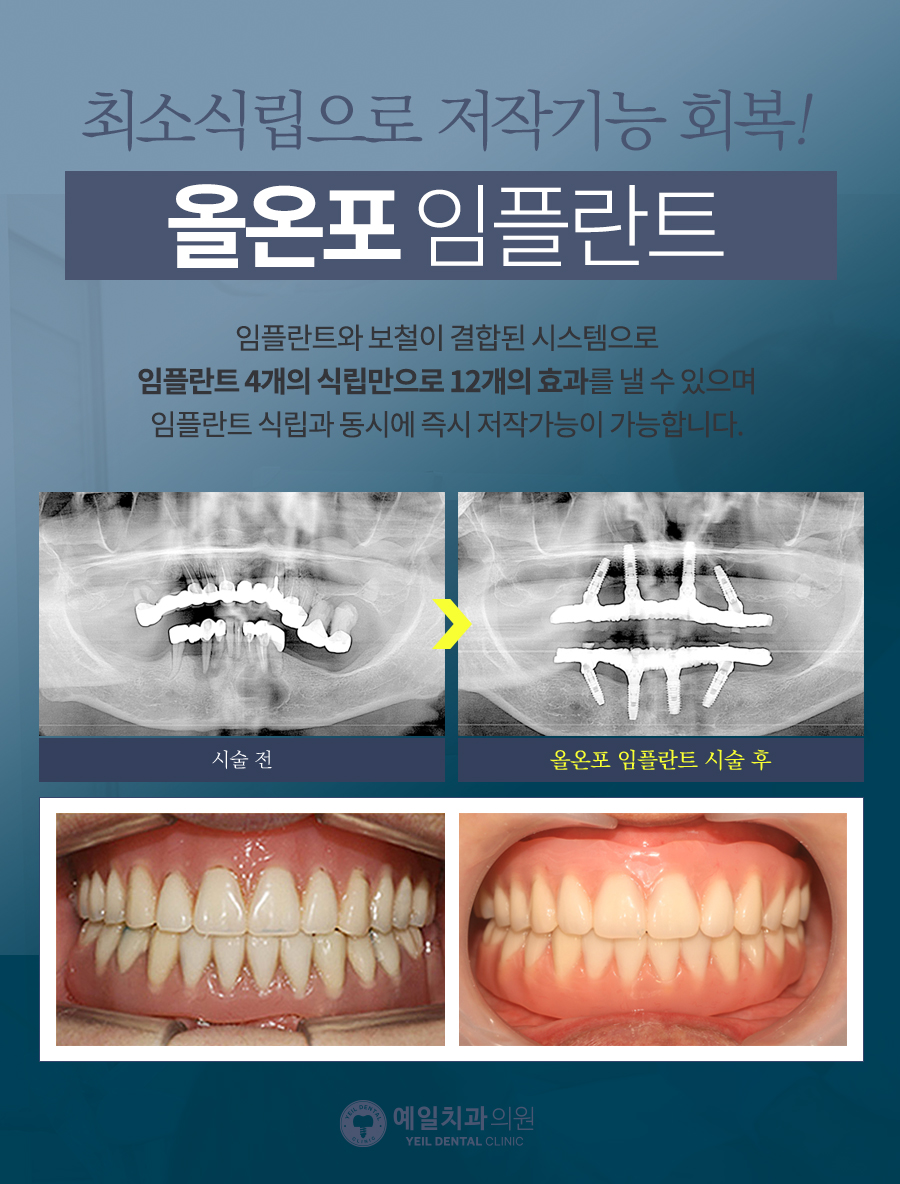 연세예일치과 이미지