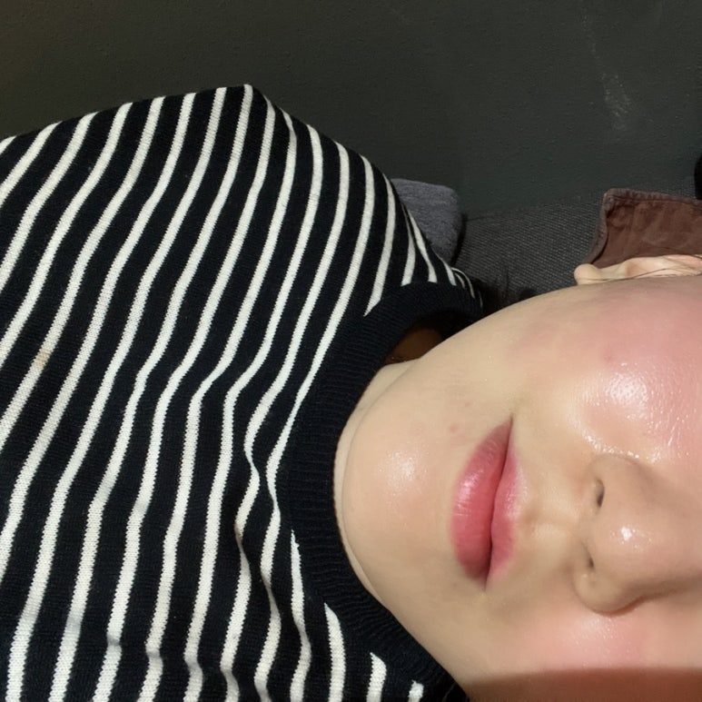 톡스앤필의원 대전둔산점 이미지