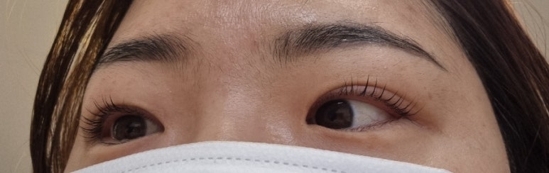블링아이즈 이미지