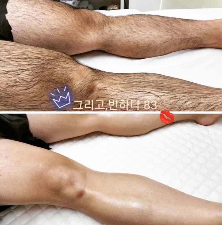 그리고;반하다83 이미지