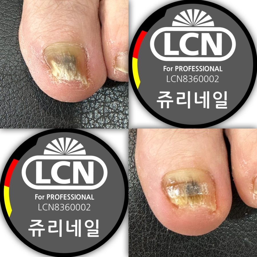 쥬리네일 이미지