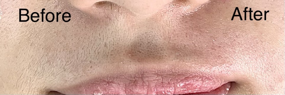 썬헤어라인 이미지