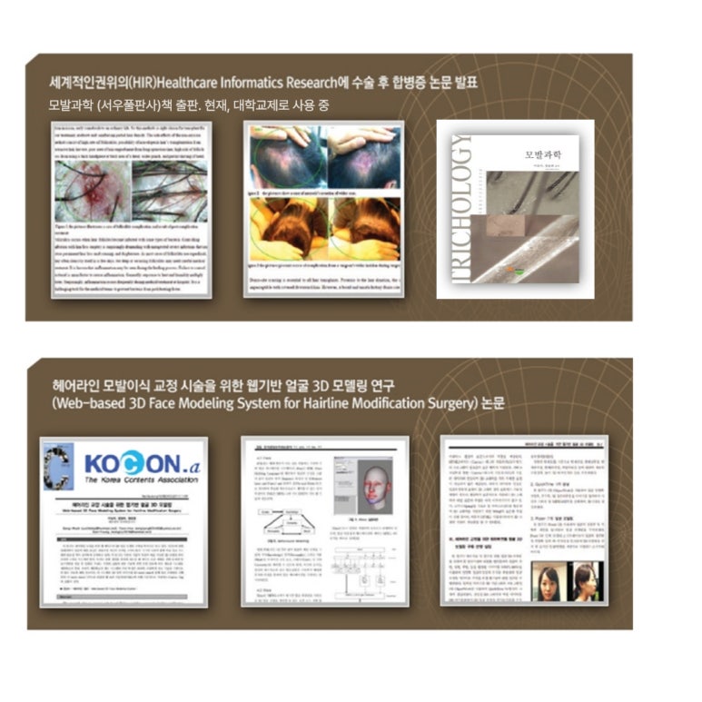 주식회사 탈모연구소 이미지