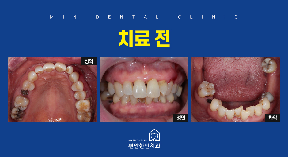 편안한민치과 이미지
