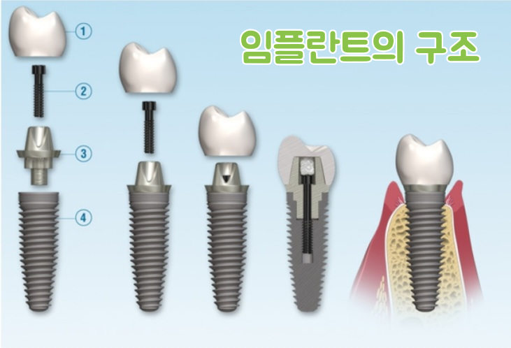 서울진이치과 이미지